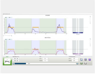Myo200生物刺激反饋治療儀 Myo200生物刺激反饋治療儀