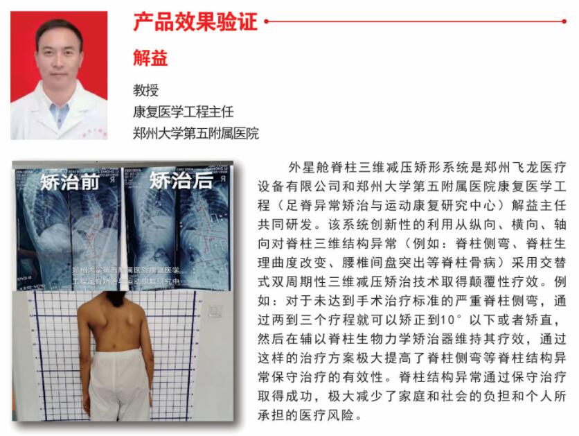 外星艙三維脊柱減壓矯形系統治療效果 外星艙三維脊柱減壓矯形系統治療效果